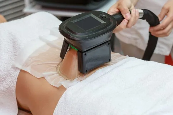 Image of person having fat freezing treatment to help weight gain Edinburgh