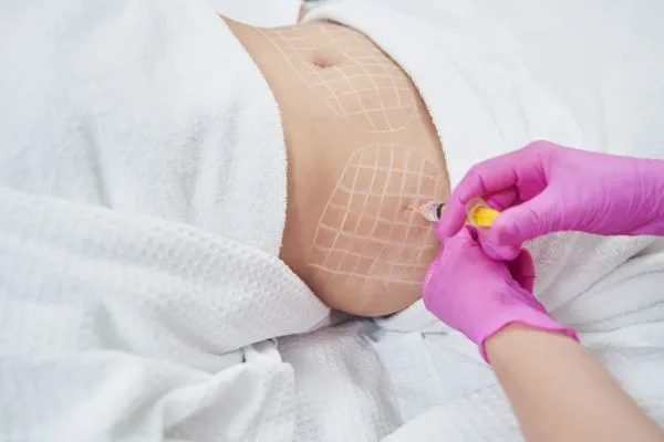 image of fat dissolving injections on love handles to help combat weight gain Edinburgh