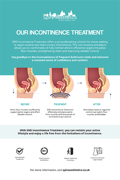 image to show how EMS treatment works for female urinary incontinence Edinburgh
