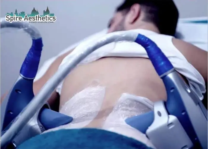 Man having fat freezing treatment done on love handles before a competitions Edinburgh to create a sculpted look.