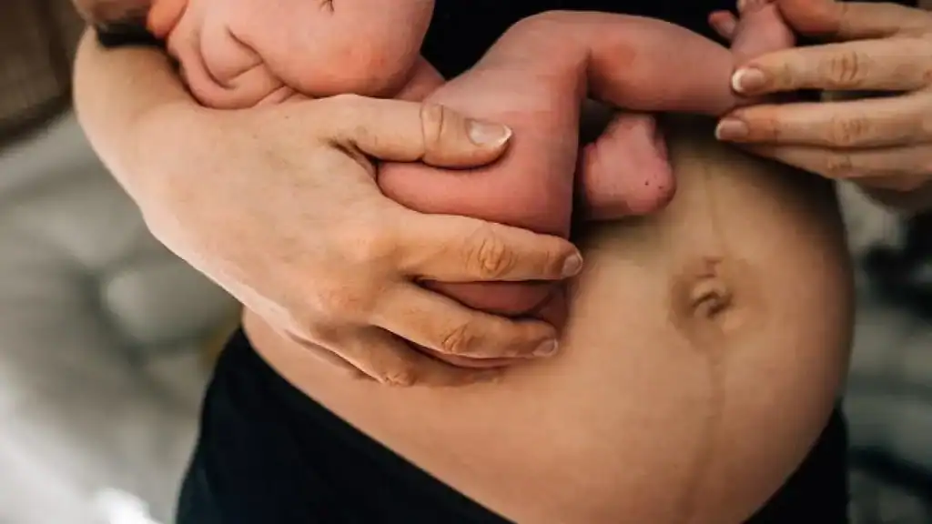Why Is My Stomach Still Big After Pregnancy Edinburgh?
